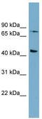 Frizzled Class Receptor 6 antibody, TA344064, Origene, Western Blot image 