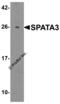 Spermatogenesis Associated 3 antibody, 6551, ProSci, Western Blot image 