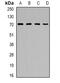 Carnosine Dipeptidase 1 antibody, abx225117, Abbexa, Western Blot image 