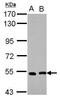 SET And MYND Domain Containing 1 antibody, GTX119484, GeneTex, Western Blot image 