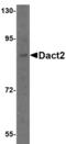 Dishevelled Binding Antagonist Of Beta Catenin 2 antibody, LS-B3853, Lifespan Biosciences, Western Blot image 
