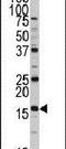 DCTP Pyrophosphatase 1 antibody, PA5-12428, Invitrogen Antibodies, Western Blot image 