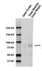 Sodium Channel Epithelial 1 Alpha Subunit antibody, TA326579, Origene, Western Blot image 