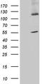 Synaptotagmin 11 antibody, CF810985, Origene, Western Blot image 