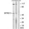 Serine And Arginine Rich Splicing Factor 11 antibody, PA5-50142, Invitrogen Antibodies, Western Blot image 