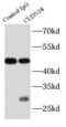 Claudin 18 antibody, FNab01735, FineTest, Immunoprecipitation image 