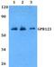 Adhesion G Protein-Coupled Receptor A1 antibody, PA5-75823, Invitrogen Antibodies, Western Blot image 