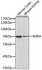Nuclear receptor ROR-alpha antibody, GTX55784, GeneTex, Western Blot image 