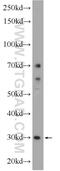 DNA damage-regulated autophagy modulator protein 2 antibody, 23182-1-AP, Proteintech Group, Enzyme Linked Immunosorbent Assay image 