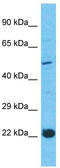Reca antibody, TA333547, Origene, Western Blot image 