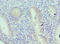 CD218b antibody, LS-C375950, Lifespan Biosciences, Immunohistochemistry paraffin image 