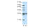 T Cell Leukemia Homeobox 2 antibody, 29-030, ProSci, Western Blot image 