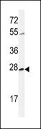 CWC15 Spliceosome Associated Protein Homolog antibody, 61-674, ProSci, Western Blot image 