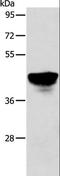 Abhydrolase Domain Containing 5 antibody, LS-C404411, Lifespan Biosciences, Western Blot image 