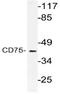 ST6 Beta-Galactoside Alpha-2,6-Sialyltransferase 1 antibody, AP21150PU-N, Origene, Western Blot image 
