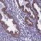B36-VDAC antibody, NBP1-89477, Novus Biologicals, Immunohistochemistry paraffin image 
