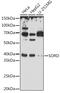 SDH antibody, GTX54728, GeneTex, Western Blot image 