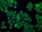 Premelanosome Protein antibody, M01262-2, Boster Biological Technology, Immunofluorescence image 
