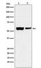 Ubiquitin carboxyl-terminal hydrolase 22 antibody, M03887-1, Boster Biological Technology, Western Blot image 