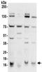 PCNA Clamp Associated Factor antibody, NBP2-32112, Novus Biologicals, Western Blot image 