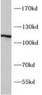Synaptopodin antibody, FNab08423, FineTest, Western Blot image 