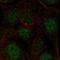 Coiled-Coil Domain Containing 63 antibody, HPA061568, Atlas Antibodies, Immunocytochemistry image 