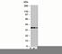 PDZ And LIM Domain 1 antibody, N1181-100UG, NSJ Bioreagents, Western Blot image 