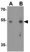 Prolyl 4-Hydroxylase Subunit Beta antibody, GTX31623, GeneTex, Western Blot image 