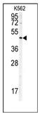 Doublecortin antibody, AP12410PU-N, Origene, Western Blot image 
