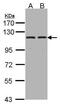 Glutamyl Aminopeptidase antibody, PA5-27798, Invitrogen Antibodies, Western Blot image 