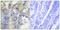 Collagen alpha-5(IV) chain antibody, LS-C119458, Lifespan Biosciences, Immunohistochemistry paraffin image 