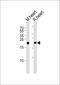 PRDX2 antibody, MBS9212850, MyBioSource, Western Blot image 