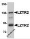Protein transport protein Sec16B antibody, 5623, ProSci Inc, Western Blot image 