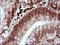 LIM Domain Only 2 antibody, LS-C788062, Lifespan Biosciences, Immunohistochemistry frozen image 