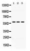 Aldehyde Dehydrogenase 7 Family Member A1 antibody, PA5-78759, Invitrogen Antibodies, Western Blot image 