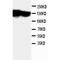 Lymphocyte antigen 6A-2/6E-1 antibody, orb27542, Biorbyt, Western Blot image 