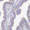 Dynein Axonemal Heavy Chain 14 antibody, HPA031379, Atlas Antibodies, Immunohistochemistry paraffin image 