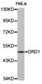 D(1A) dopamine receptor antibody, TA327434, Origene, Western Blot image 
