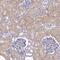 Family With Sequence Similarity 83 Member E antibody, PA5-61928, Invitrogen Antibodies, Immunohistochemistry paraffin image 