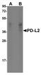 B7-DC antibody, TA355064, Origene, Western Blot image 