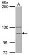 Glucosidase Alpha, Neutral C antibody, GTX112559, GeneTex, Western Blot image 