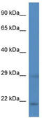 Heart- and neural crest derivatives-expressed protein 2 antibody, TA329158, Origene, Western Blot image 