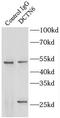 Dynactin Subunit 6 antibody, FNab02276, FineTest, Immunoprecipitation image 