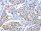 Integrin Binding Sialoprotein antibody, LS-B15317, Lifespan Biosciences, Immunohistochemistry paraffin image 