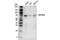 Methylenetetrahydrofolate Reductase antibody, 25164S, Cell Signaling Technology, Western Blot image 