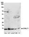 Dynein light chain Tctex-type 1 antibody, A304-819A, Bethyl Labs, Western Blot image 