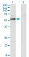 UDP-N-Acetylglucosamine Pyrophosphorylase 1 antibody, LS-C198250, Lifespan Biosciences, Western Blot image 
