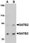 SATB Homeobox 2 antibody, orb94260, Biorbyt, Western Blot image 
