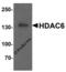 Histone Deacetylase 6 antibody, 7901, ProSci Inc, Western Blot image 