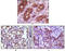 BLK Proto-Oncogene, Src Family Tyrosine Kinase antibody, M01539-1, Boster Biological Technology, Immunohistochemistry frozen image 